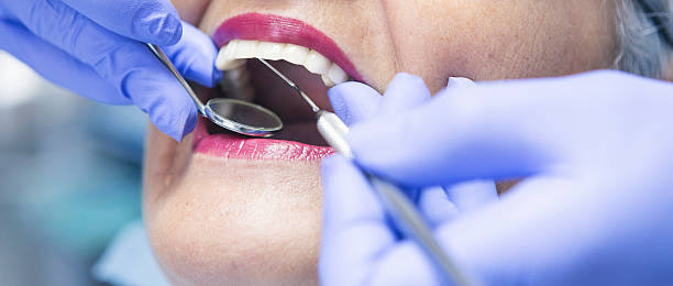Best Emergency Dental Extractions in Ballinger, TX